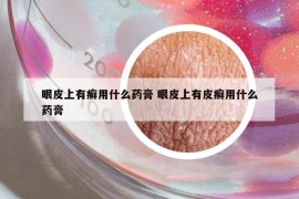 眼皮上有癣用什么药膏 眼皮上有皮癣用什么药膏