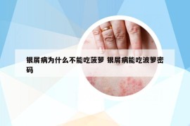 银屑病为什么不能吃菠萝 银屑病能吃波箩密码