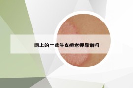 网上的一些牛皮癣老师靠谱吗