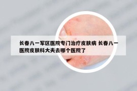 长春八一军区医院专门治疗皮肤病 长春八一医院皮肤科大夫去哪个医院了