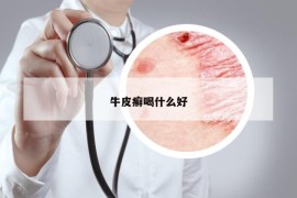 牛皮癣喝什么好