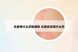 头藓用什么药能根除 头藓应该用什么药