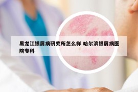 黑龙江银屑病研究所怎么样 哈尔滨银屑病医院专科