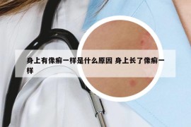 身上有像癣一样是什么原因 身上长了像癣一样