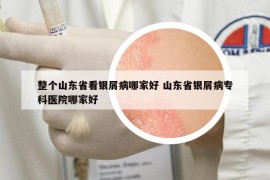 整个山东省看银屑病哪家好 山东省银屑病专科医院哪家好