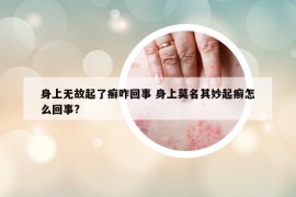 身上无故起了癣咋回事 身上莫名其妙起癣怎么回事?