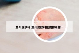 兰州皮肤科 兰州皮肤科医院排名第一