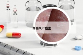 白癜风ct检查