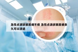 急性点滴状银屑病不痒 急性点滴状银屑病多久可以消退