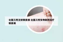 北医三院注射银屑病 北医三院生物制剂治疗银屑病