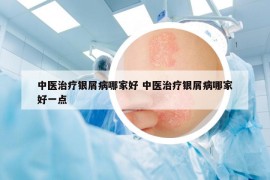 中医治疗银屑病哪家好 中医治疗银屑病哪家好一点