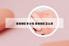 紫椒癣酊多少钱 紫椒癣酊怎么读