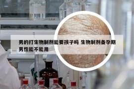 男的打生物制剂能要孩子吗 生物制剂备孕期男性能不能用