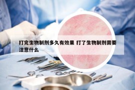 打完生物制剂多久有效果 打了生物制剂需要注意什么