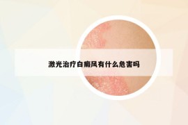 激光治疗白癜风有什么危害吗