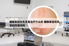 醋酸氟轻松乳膏是治疗什么的 醋酸氟轻松乳膏的作用功效