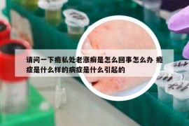 请问一下瘾私处老涨癣是怎么回事怎么办 瘾症是什么样的病症是什么引起的