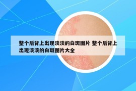 整个后背上出现淡淡的白斑图片 整个后背上出现淡淡的白斑图片大全