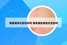 银屑病多吃苦瓜好吗 银屑病患者能吃苦瓜吗