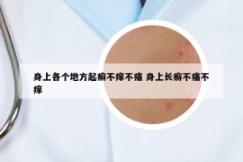 身上各个地方起癣不痒不痛 身上长癣不痛不痒