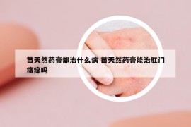 苗天然药膏都治什么病 苗天然药膏能治肛门瘙痒吗