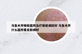 乌鲁木齐哪些医院治疗银屑病较好 乌鲁木齐什么医院看皮肤病好