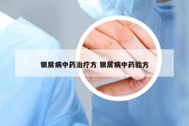 银屑病中药治疗方 银屑病中药验方