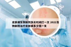 皮肤病生物制剂多长时间打一次 2021生物制剂治疗皮肤病多少钱一支