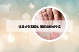 银屑病专家医生 银屑病权威专家