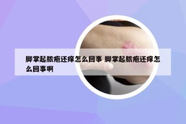 脚掌起脓疱还痒怎么回事 脚掌起脓疱还痒怎么回事啊