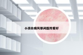 小孩白癜风那间医院看好