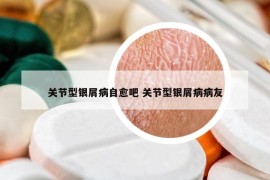 关节型银屑病自愈吧 关节型银屑病病友