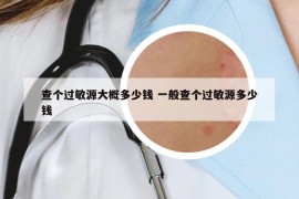 查个过敏源大概多少钱 一般查个过敏源多少钱