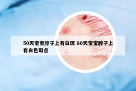 50天宝宝脖子上有白斑 80天宝宝脖子上有白色斑点