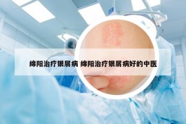 绵阳治疗银屑病 绵阳治疗银屑病好的中医