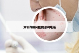 深圳白癜风医院咨询电话