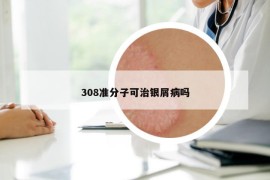 308准分子可治银屑病吗