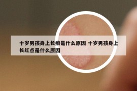 十岁男孩身上长癣是什么原因 十岁男孩身上长红点是什么原因