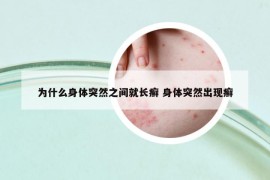 为什么身体突然之间就长癣 身体突然出现癣