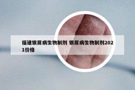 福建银屑病生物制剂 银屑病生物制剂2021价格