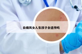 白癜风女人生孩子会遗传吗