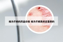 维方疗癣的药品价格 维方疗癣真的还是假的