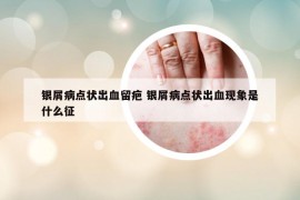 银屑病点状出血留疤 银屑病点状出血现象是什么征