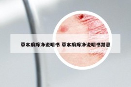 草本癣痒净说明书 草本癣痒净说明书禁忌