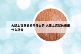 大腿上突然长癣用什么药 大腿上突然长癣用什么药膏