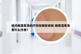 请问癣湿毒清的疗效有哪些谢谢 癣痒湿毒清有什么作用?