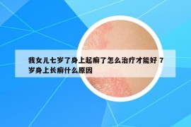 我女儿七岁了身上起癣了怎么治疗才能好 7岁身上长癣什么原因