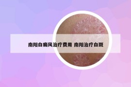 南阳白癜风治疗费用 南阳治疗白斑