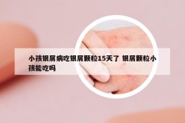 小孩银屑病吃银屑颗粒15天了 银屑颗粒小孩能吃吗