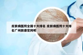 皮肤病医院全国十大排名 皮肤病医院十大排名广州肤康官网呢